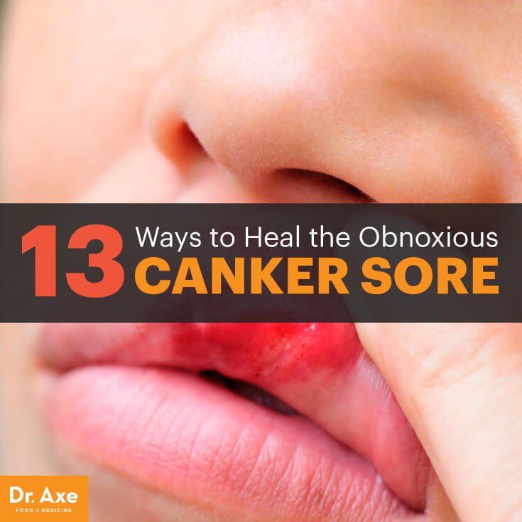 Canker Sore Symptoms Types Natural Remedies Dr Axe