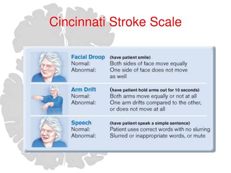 Cincinnati Stroke Scale Scoring