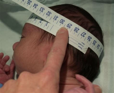 Circumference Newborn Head