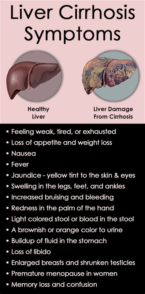 Cirrhosis Of The Liver Symptoms Causes And Treatment