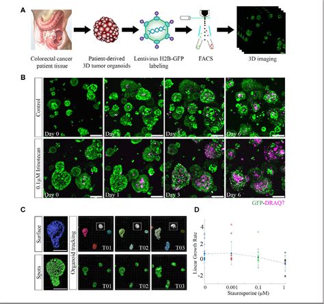 Comparison Of Cell And Organoid Level Analysis Of Patient Derived 3D