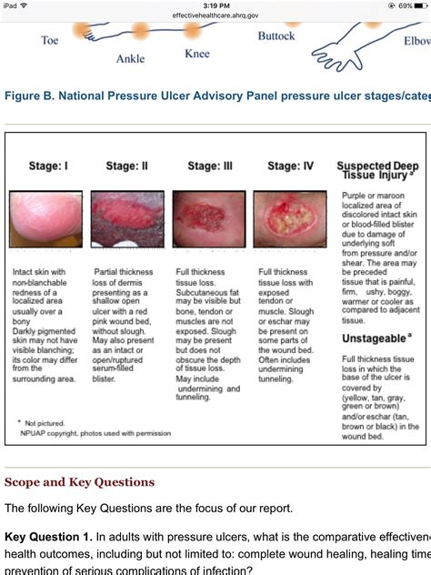 Comprehensive Guide: Managing Stage 3 Wounds