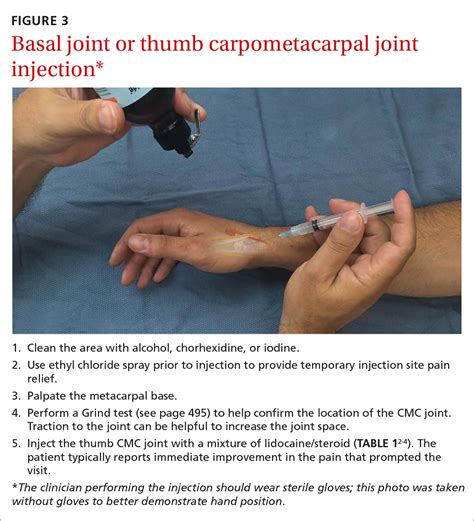 Cortisone Trigger Point Injections Medical Exhibits Demonstrative