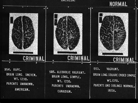 Criminal Vs Normal Brain Table