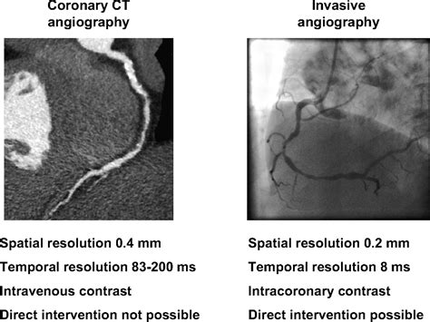 Cta Vs Angiogram