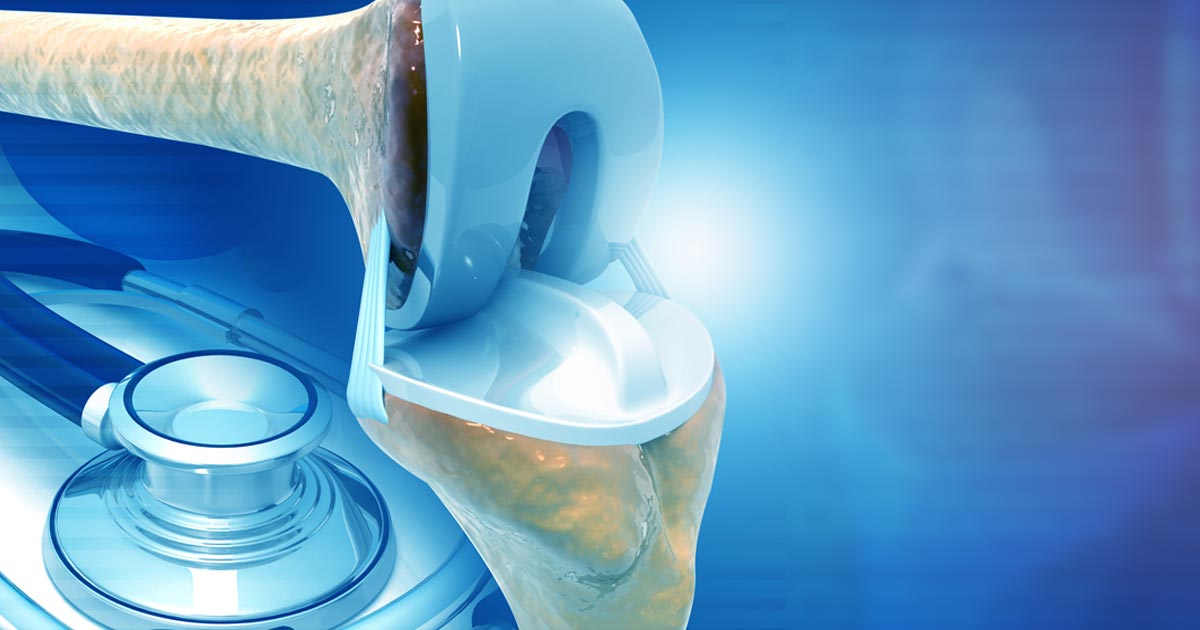 Current Concepts In Joint Replacement Medbridge Joint Replacement