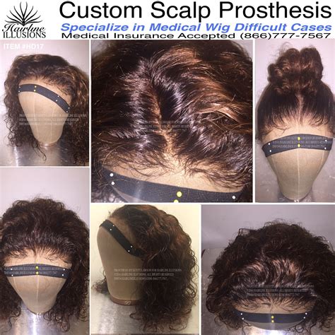 Custom Medical Wigs Cranial Prosthesis Wig Class Reviews Egypt