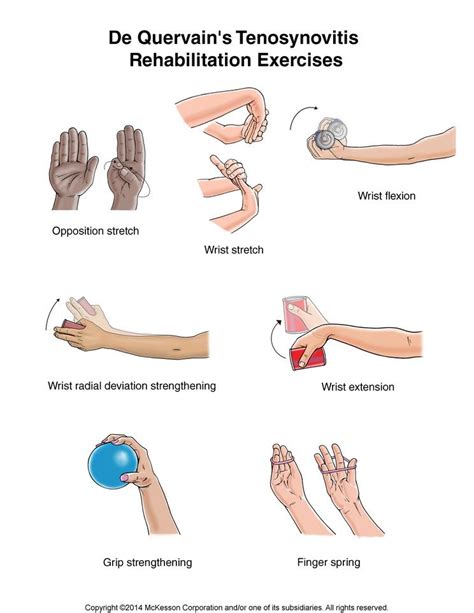 De Quervain Amp 39 S Tenosynovitis Exercises Illustration Physical