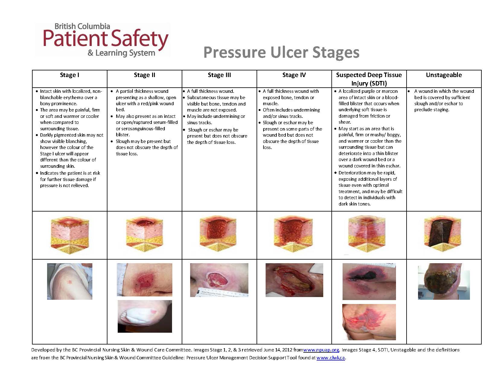 Decubitus Ulcer Guide: Healing Stages