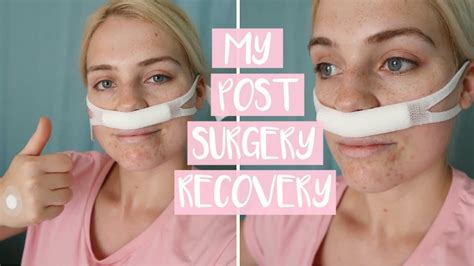 Deviated Septum Operation Recovery