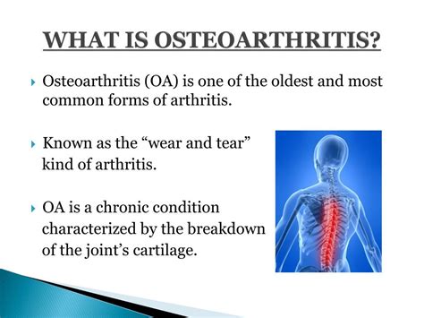 Diagnosis And Treatment Of Osteoarthritis Ppt Download