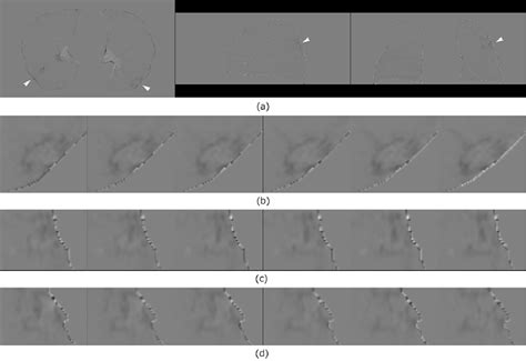 Diffeomorphic Models Unlocked: Deformable Shapes