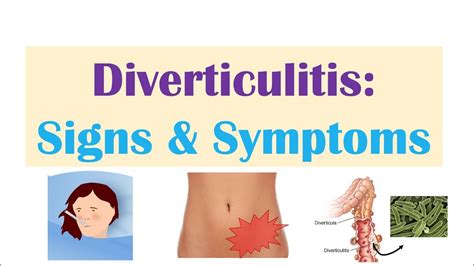 Diverticulitis Signs Symptoms And Why They Occur