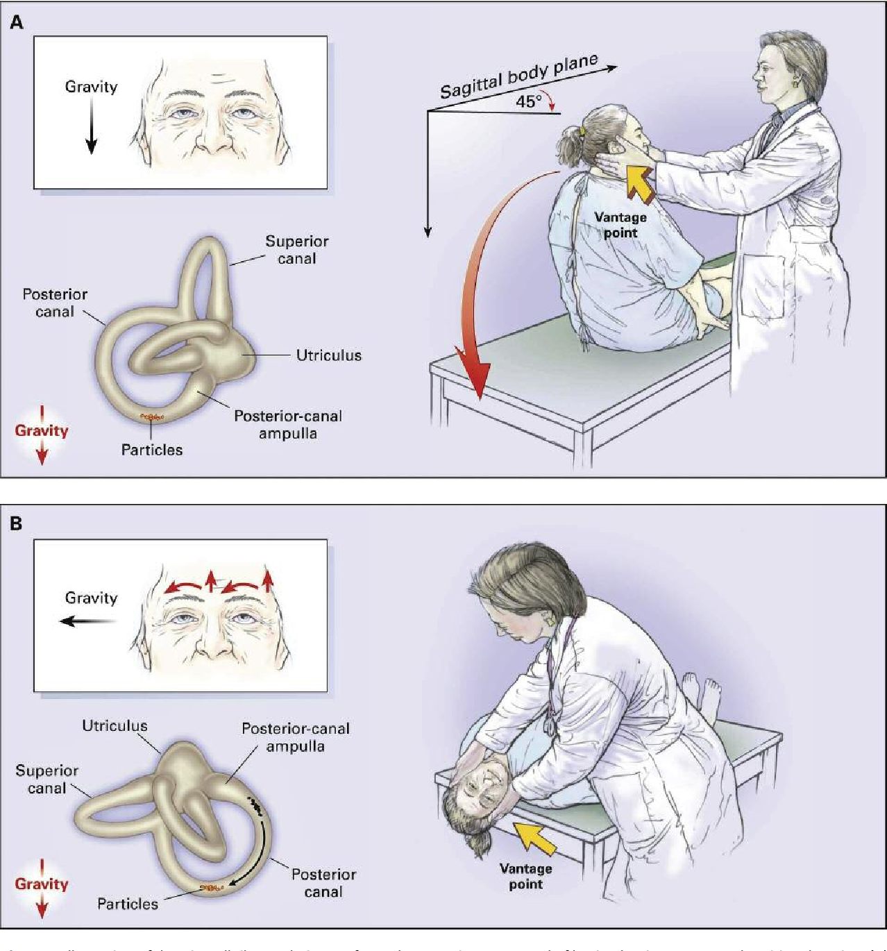 Dizziness Vs Vertigo Medizzy