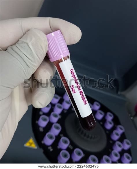 Doctor Hand Holding Blood Sample Comprehensive Stock Photo 2224602495