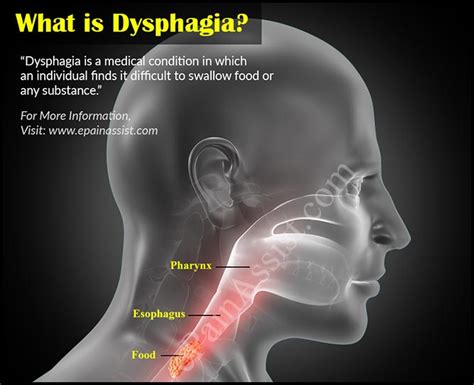 Dysphagia Symptoms Causes Treatments Dallas Tx Kedia