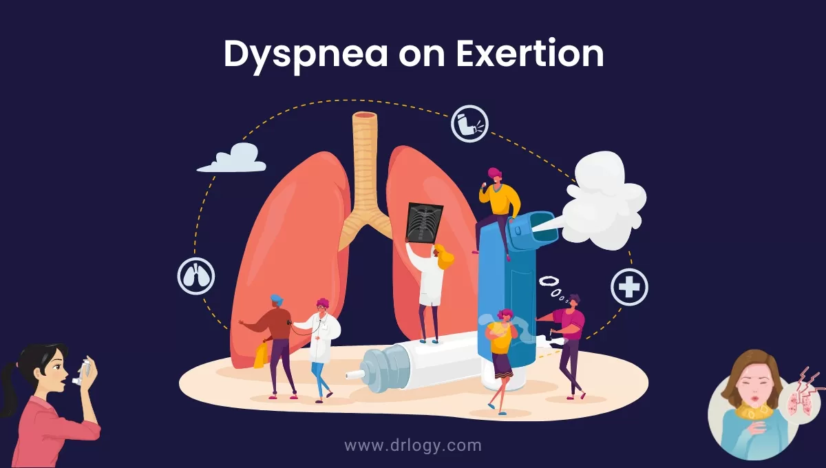 Dyspnea On Exertion Guide: Simplified Coding