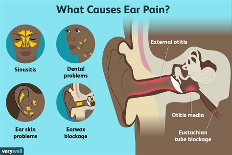 Earache When I Burp