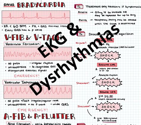 Ekg Amp Dysrhythmia Interpretation Basics For Nurses And Nursing Students