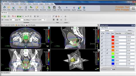 Elekta Taps Ibm Watson Health To Bring Ai Capabilities To Oncology Tech