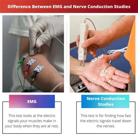 Emg Vs Nerve Conduction