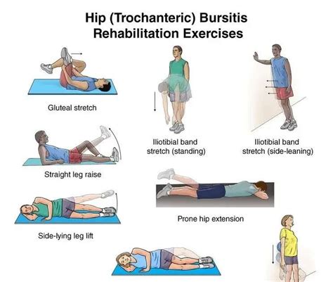 Exercise Hip Bursitis