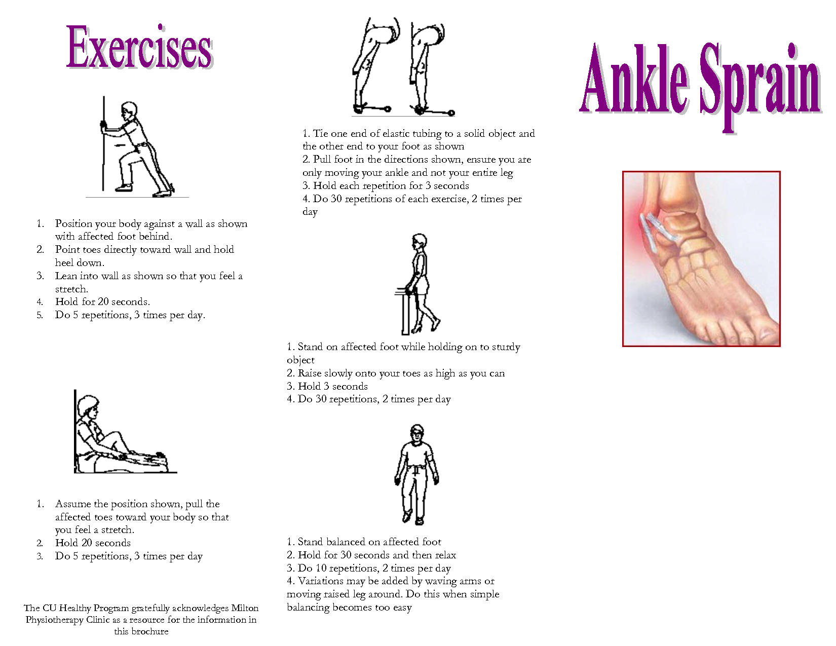 Exercises For Sprained Ankles