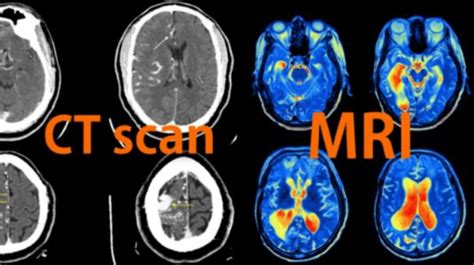 Face Ct Scan: Accurate Results