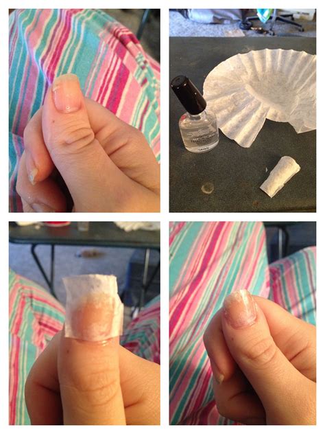 Fast And Easy Diy Methods For Fixing Cracked Or Broken Fingernails