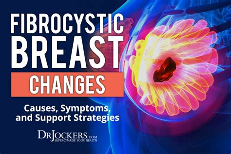 Fibrocystic Breast Changes Causes Symptoms Support Strategies