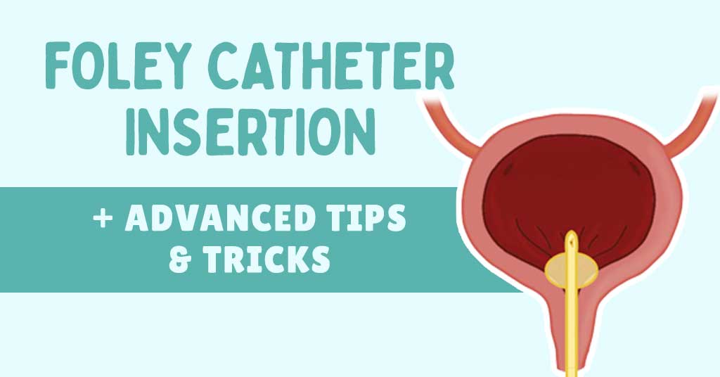 First Time Painful Foley Catheter Telegraph