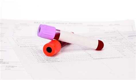 Folate Blood Test: Reveals Vitamin Levels