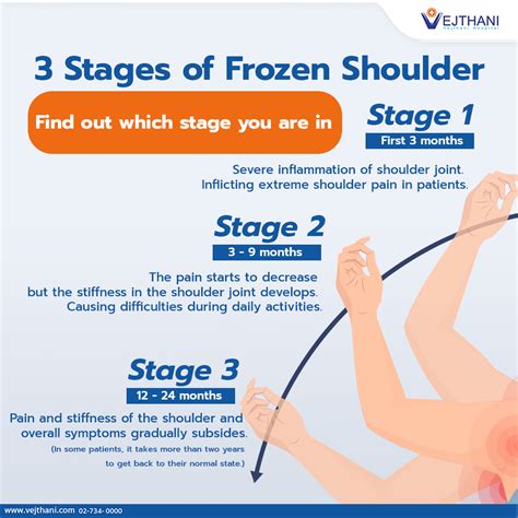 Frozen Shoulder Exercises Phases Causes Symptoms