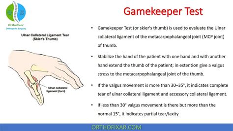 Game Keepers Thumb