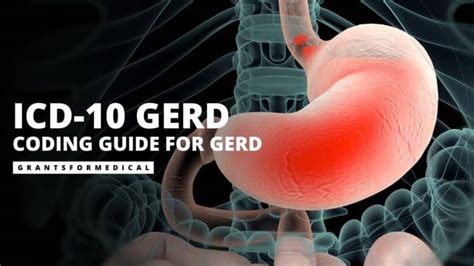 Gerd Icd 10 Codes Explained