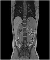 Getting Ready For Your Abdominal Ct Scan Sansum Clinic