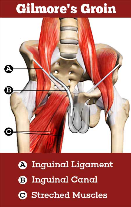 Groin Muscle Anatomy Hip Pain Explained Including Structures