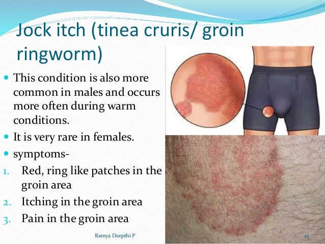 Groin Rash Female