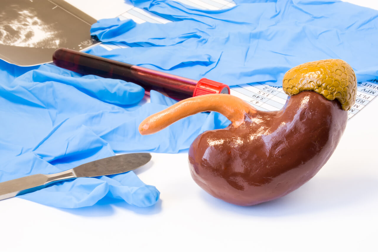 Guiding Kidney Removal