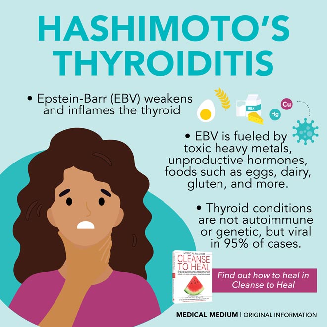 Hashimoto S Thyroiditis Risk Factors Types Causes Symptoms