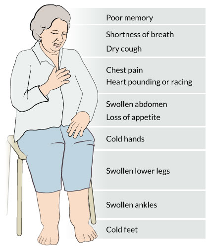 Heart Failure Self Care: Manage Symptoms Easily