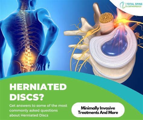 Herniated Disc Recovery Guide