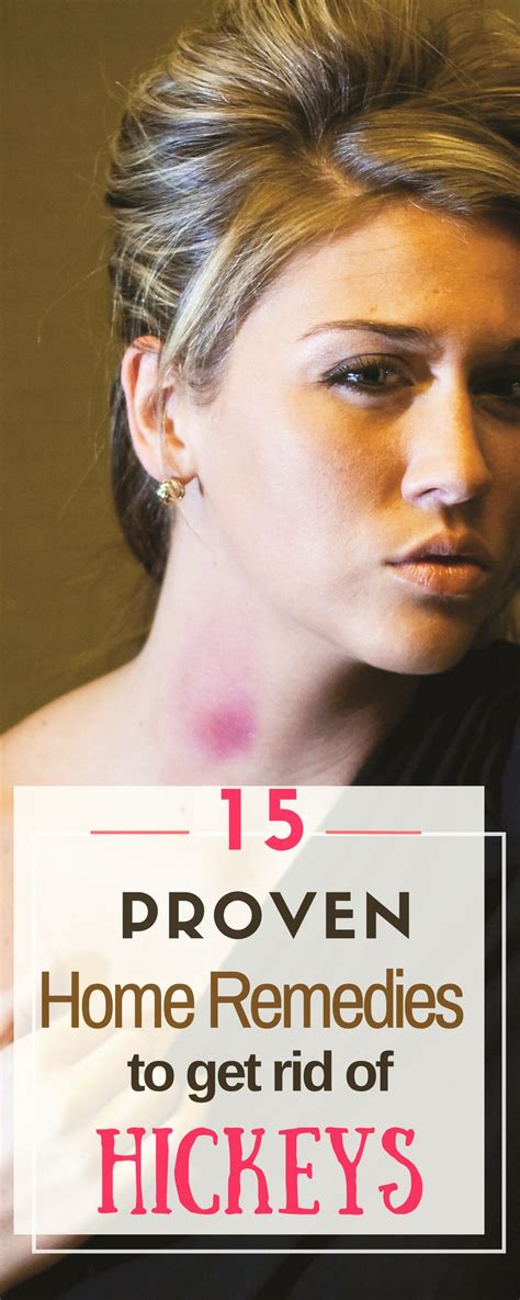 Hickeys Removal Guide: Fast Treatment