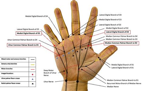 High Frequency Ultrasonography Of The Digital And Palmar Nerve Branches