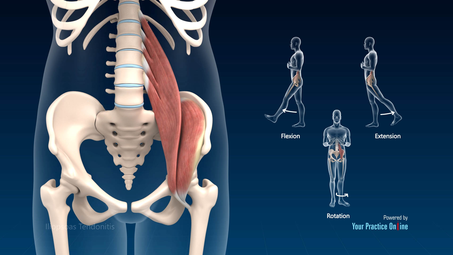 Hip Bursitis Treatment Houston Trochanteric Iliopsoas Bursa