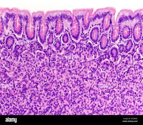 Histology Stomach Gastric Gland Pink Cells Parietal Cells