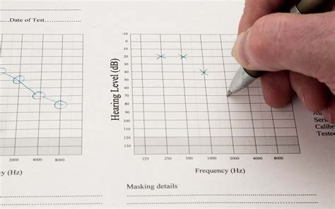 How Do I Read My Hearing Test Results Helping Me Hear