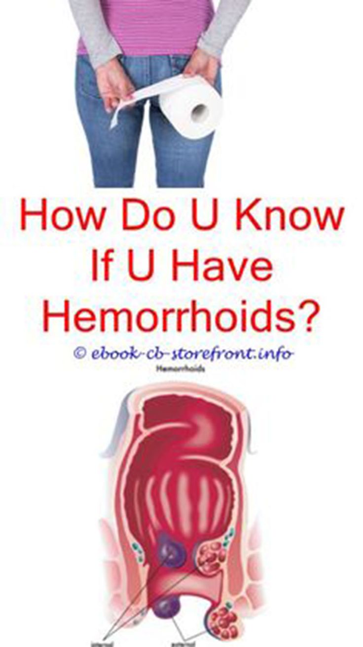 How Does Ice Cure Hemorrhoids? Fast Fix