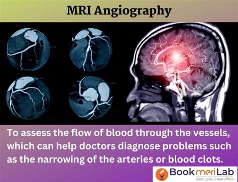 How Does Mr Angio Head Work? Pain Free Guide