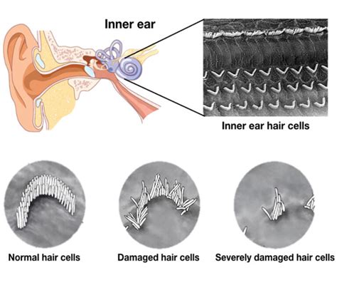 How Does Voltage Affect Hair Cells? Clear Answers